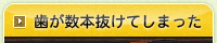 歯が数本抜けてしまった